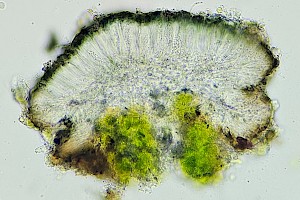 : Scoliciosporum umbrinum